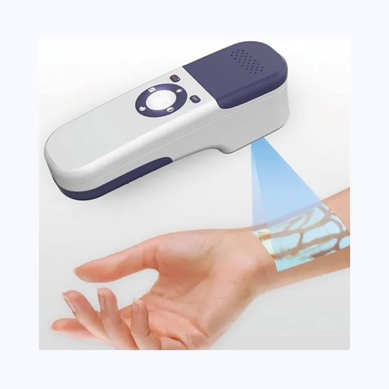 Vein Viewer
